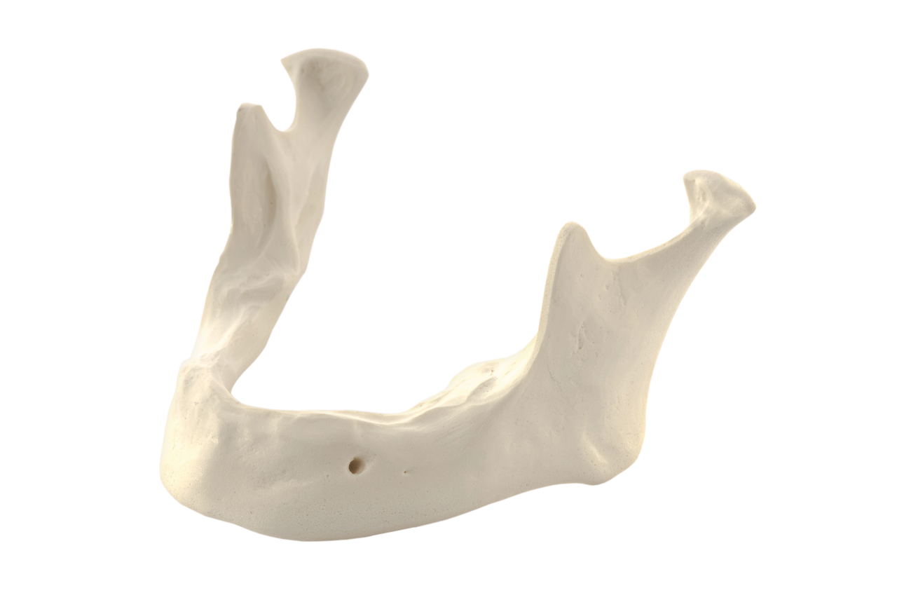 Mandibula A2 bone