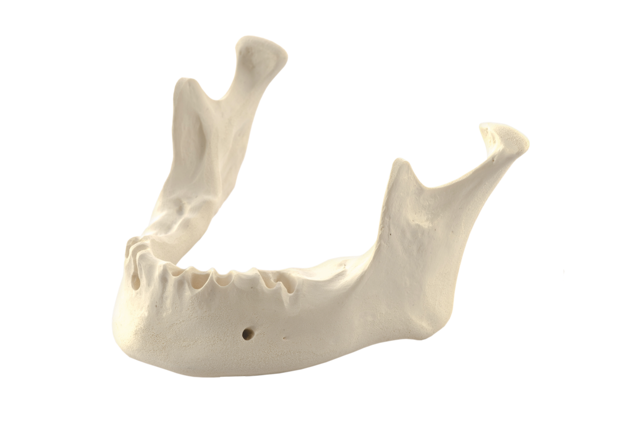 Mandibula A3 bone