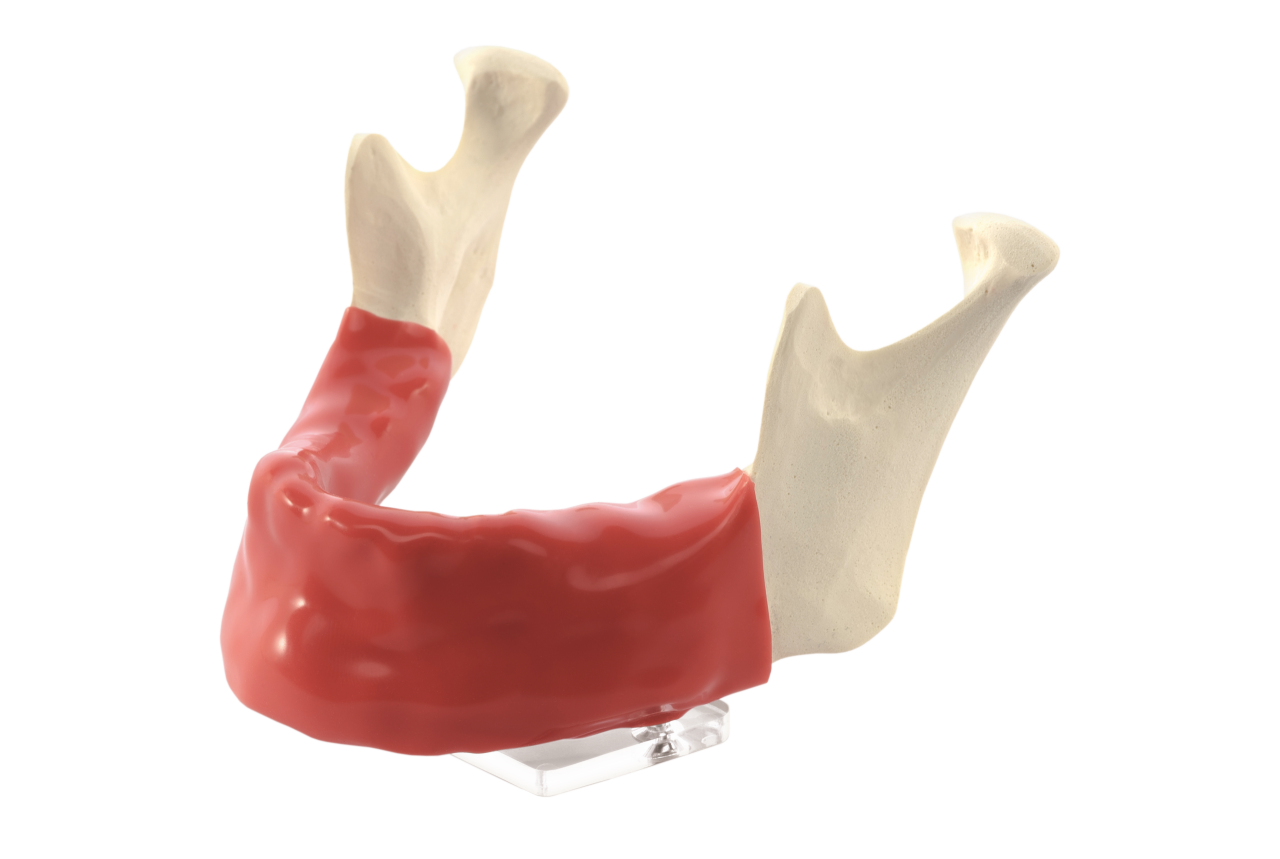 Mandibula A3 mucosa