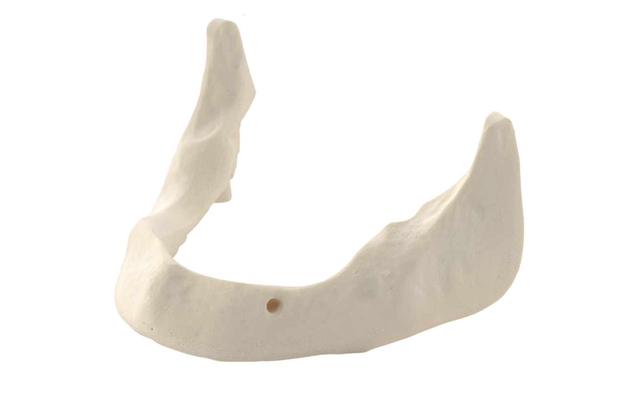 Mandibula B3 bone