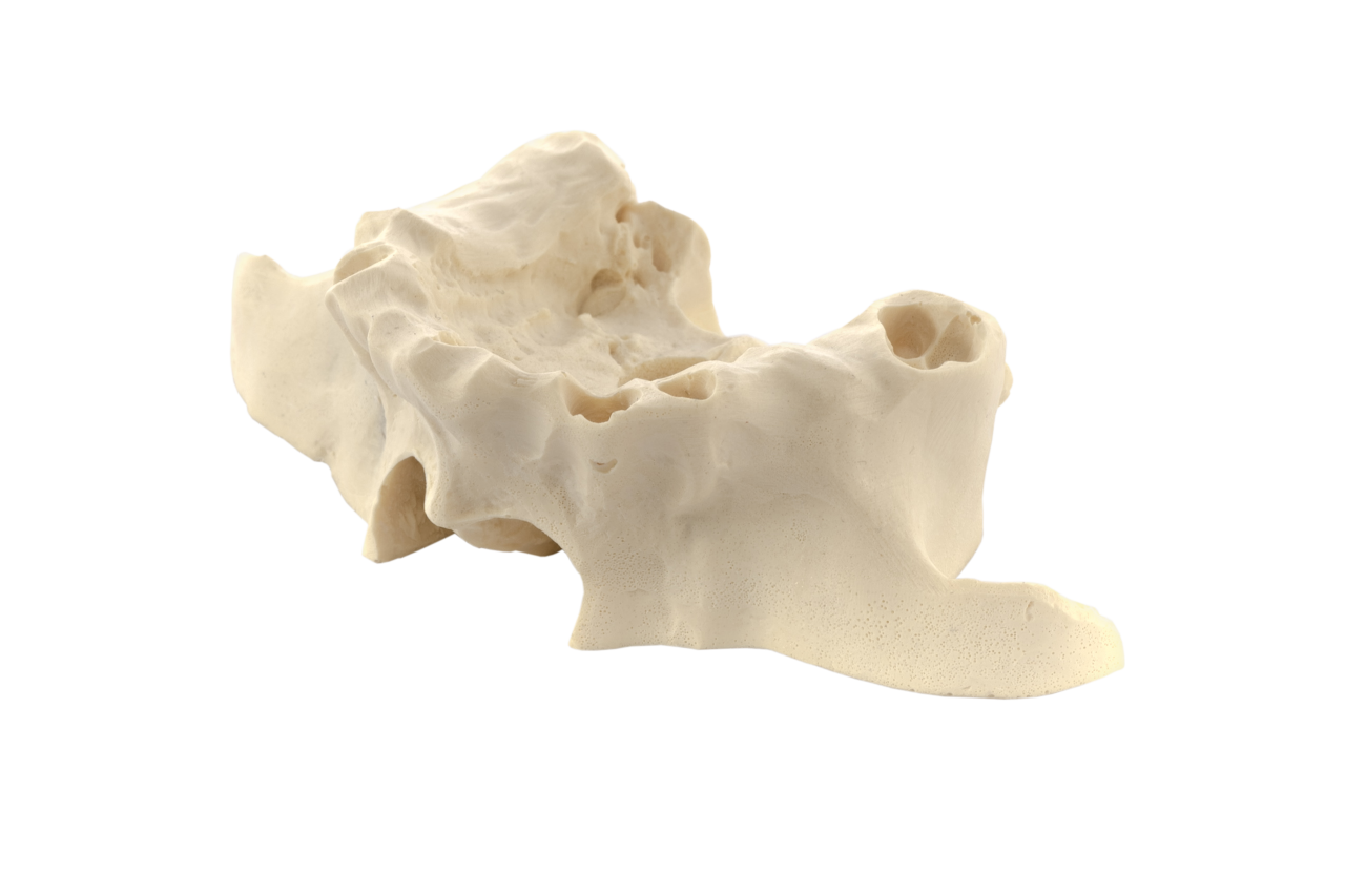 Maxilla A3 bone
