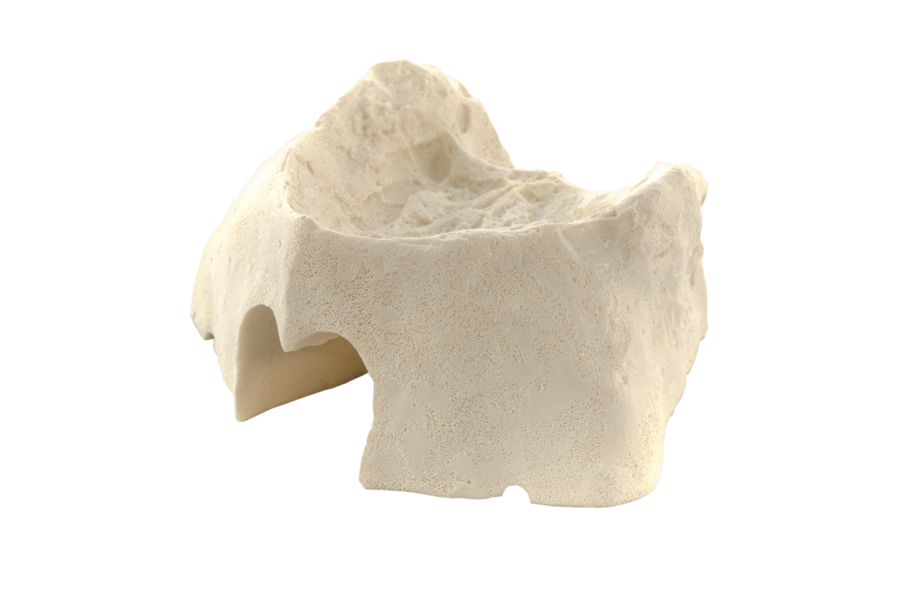Maxilla B2 bone
