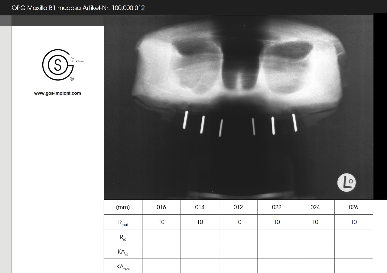 Panoramic radiograph Maxilla B1 mucosa