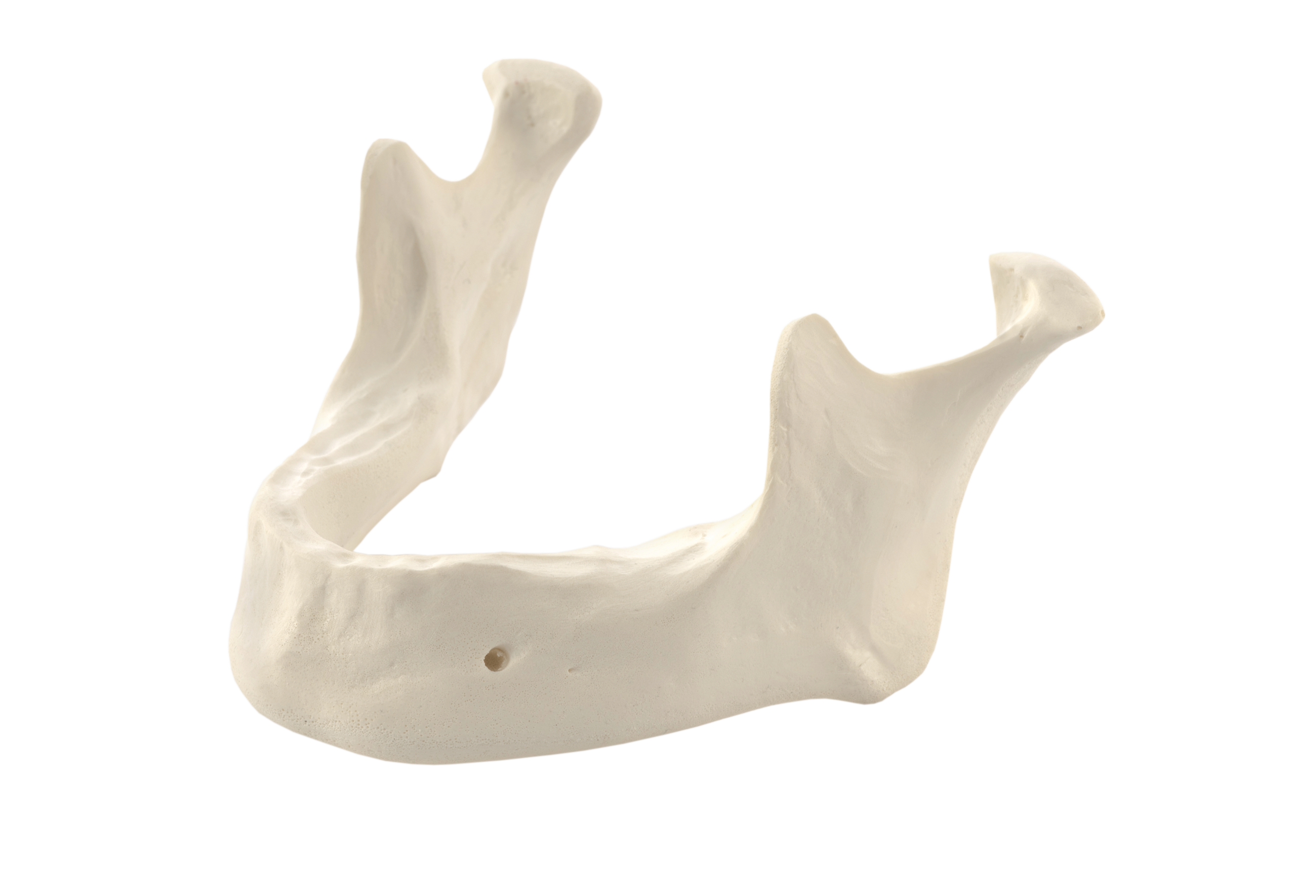 Mandibula A1 bone