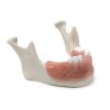 MANDIBULA A4 MUCOSA FHD gamma 360° Ansicht