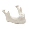 MANDIBULA A4 BONE FHD gamma 360° Ansicht