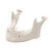 MANDIBULA A3 BONE FHD gamma 360° Ansicht